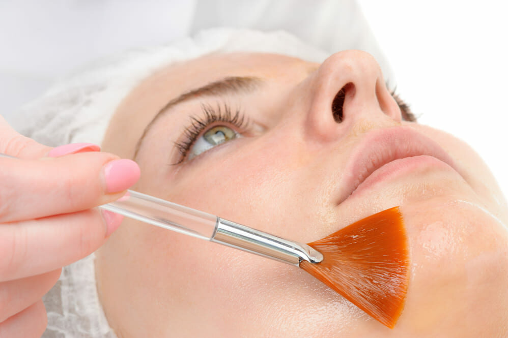 Chemische peelings toen rimpels en lijntjes bij schoonheidssalon Kalista Assen Chemische peelings toen rimpels en lijntjes bij schoonheidssalon Kalista Assen